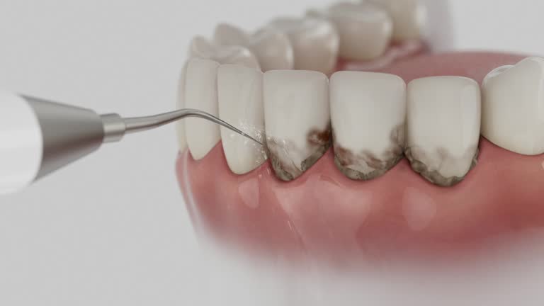 Reliable Dental contractor in Pennsboro, WV by Dentist Open Now